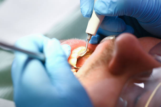 Best Weekend Emergency Dental Services in Fishers, IN