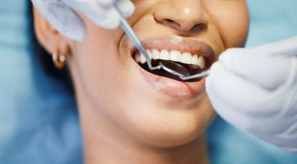Best Emergency Denture Repair in Fishers, IN
