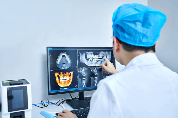 Best Knocked-Out Tooth (Avulsed Tooth) Treatment in Fishers, IN